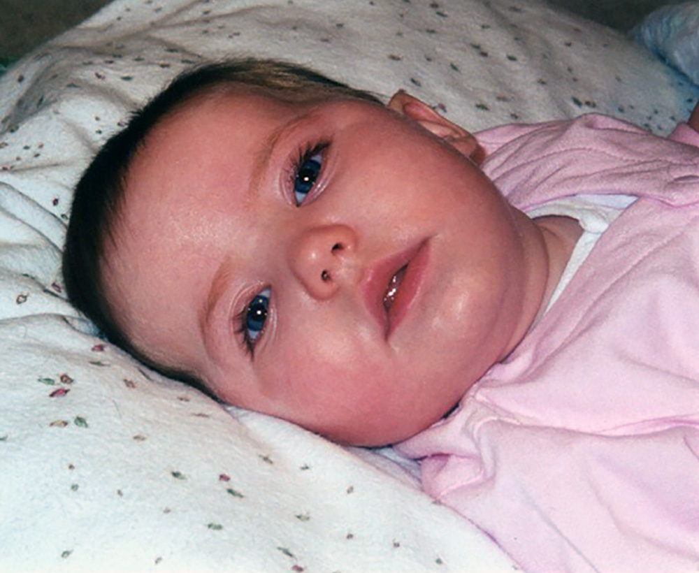 Ashley Cooper-lost her life to Krabbe disease at 18 months old.