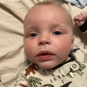 Ronan P. - KrabbeConnect - Krabbe Disease Research & Support