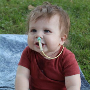 Emmett Y - KrabbeConnect - Krabbe Disease Research & Support Emmett Y - KrabbeConnect - Krabbe Disease Research & Support