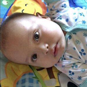Andree G. - KrabbeConnect - Krabbe Disease Research & Support